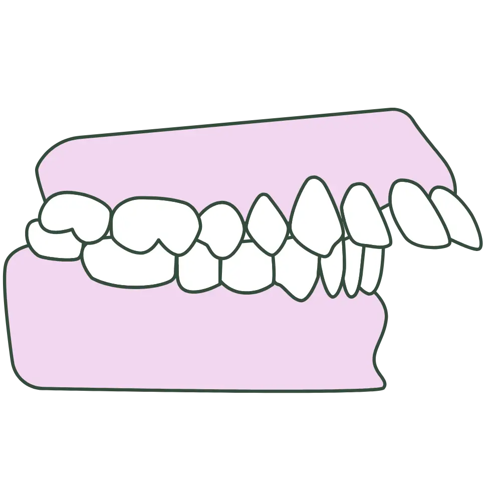 front tooth protrusion profile