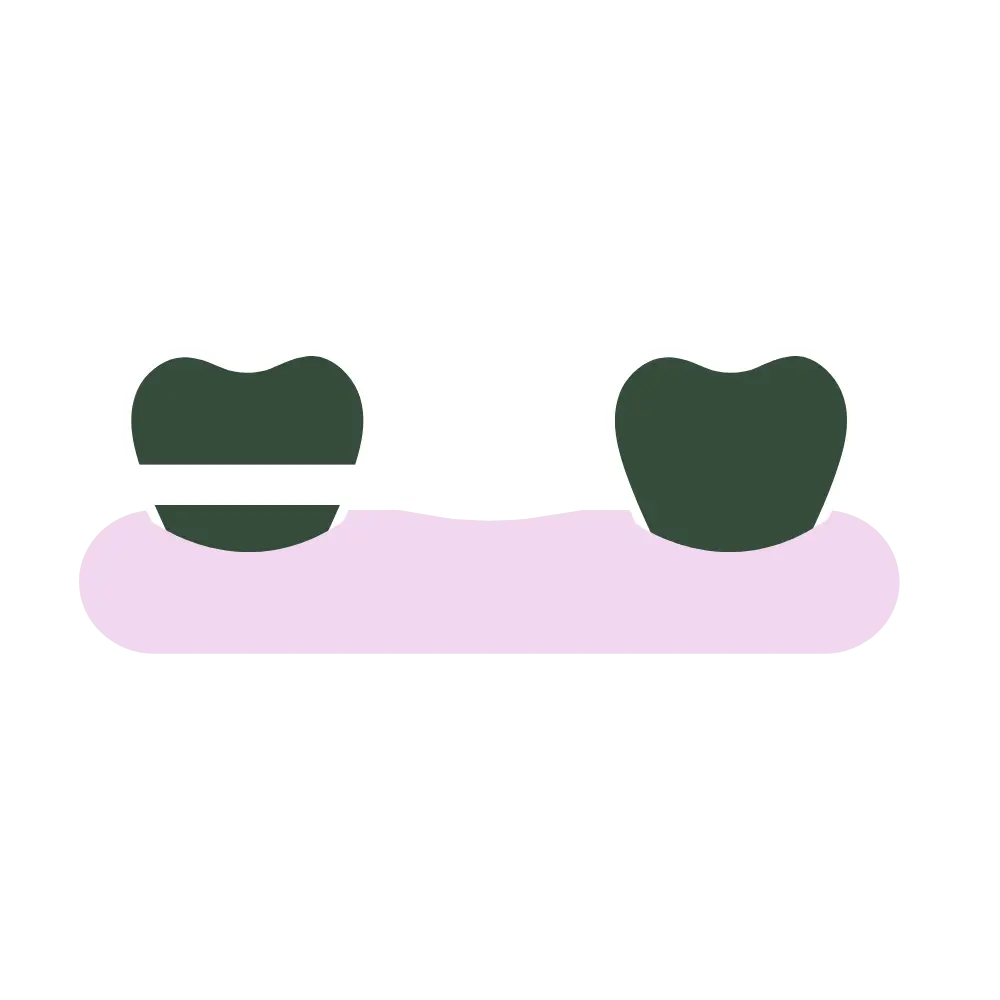 space maintainer icon